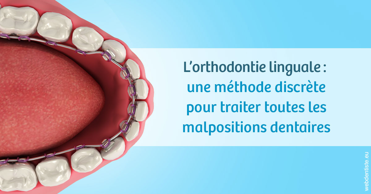 https://dr-leroy-sophie.chirurgiens-dentistes.fr/L'orthodontie linguale 1