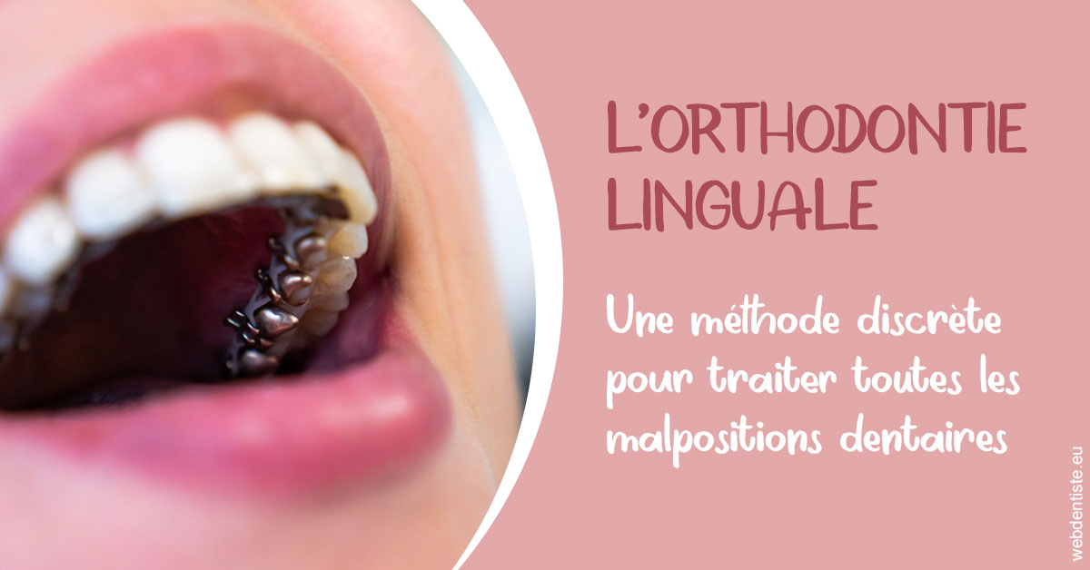 https://dr-leroy-sophie.chirurgiens-dentistes.fr/L'orthodontie linguale 2