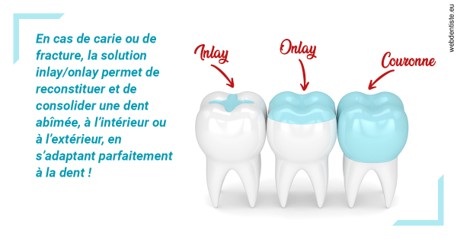 https://dr-leroy-sophie.chirurgiens-dentistes.fr/L'INLAY ou l'ONLAY