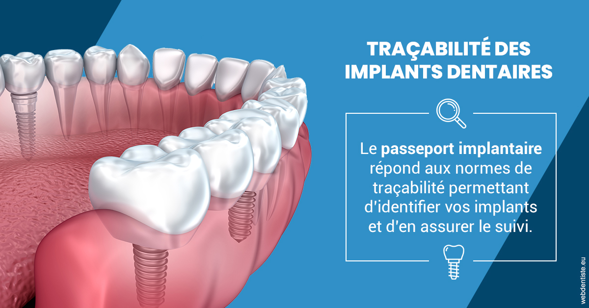 https://dr-leroy-sophie.chirurgiens-dentistes.fr/T2 2023 - Traçabilité des implants 1