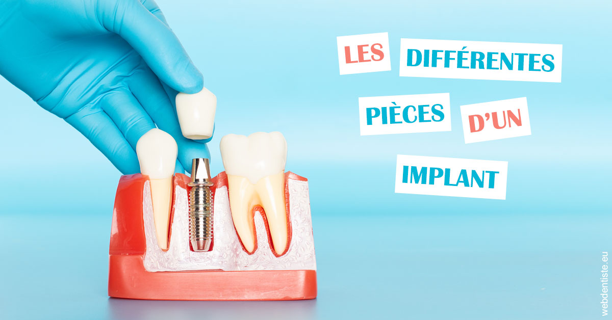 https://dr-leroy-sophie.chirurgiens-dentistes.fr/Les différentes pièces d’un implant 2