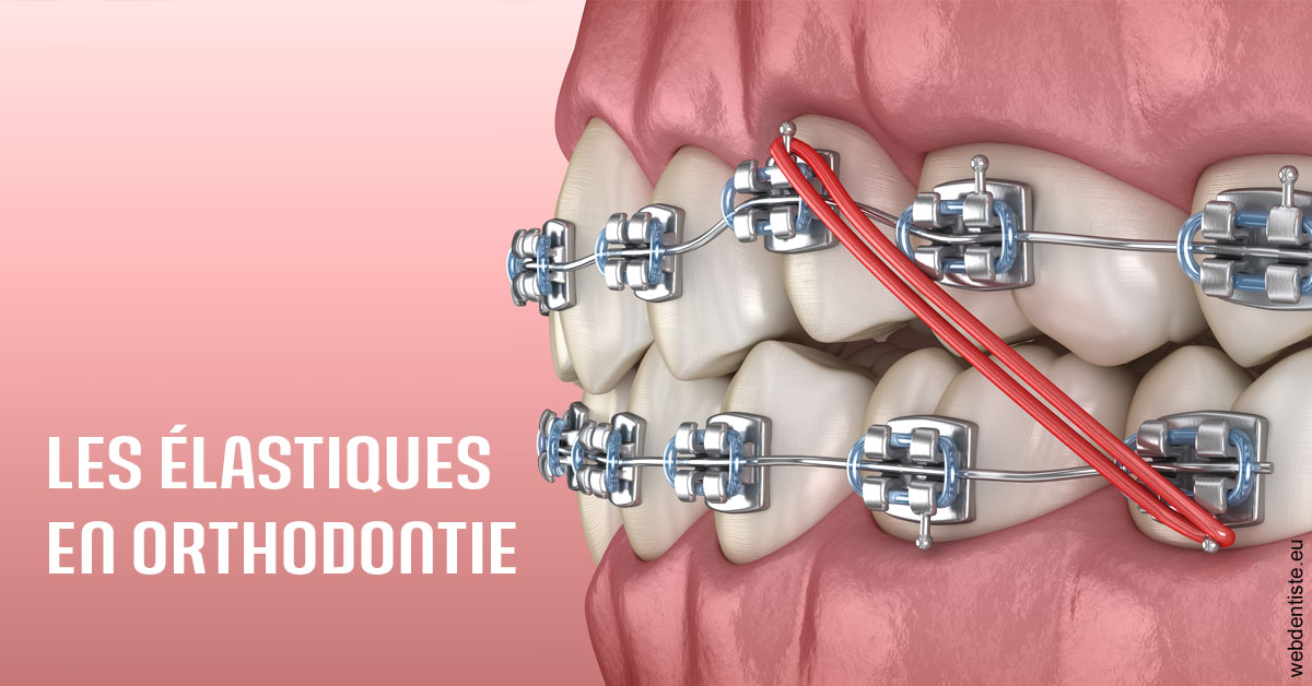 https://dr-leroy-sophie.chirurgiens-dentistes.fr/Elastiques orthodontie 2