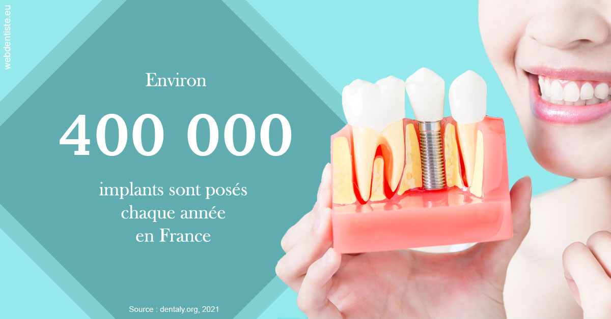 https://dr-leroy-sophie.chirurgiens-dentistes.fr/Pose d'implants en France 2